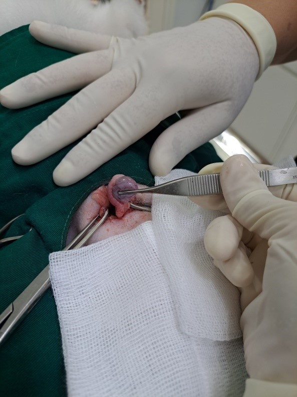 Phẫu thuật tinh hoàn ẩn tại bệnh viện Samyang