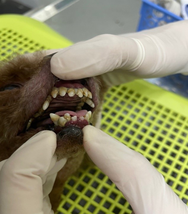 Rất nhiều mảng bám cao răng ( hình ảnh trước khi lấy cao răng)